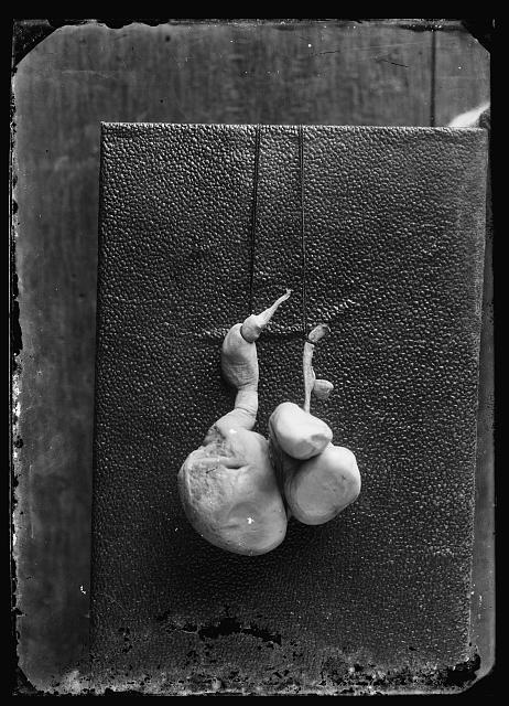 Richardson, Dr. [unidentified organ, probably human]