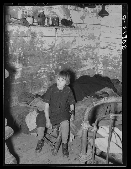 Daughter of farmer near Williston, North Dakota. Dwarfed arm probably due to infantile paralysis